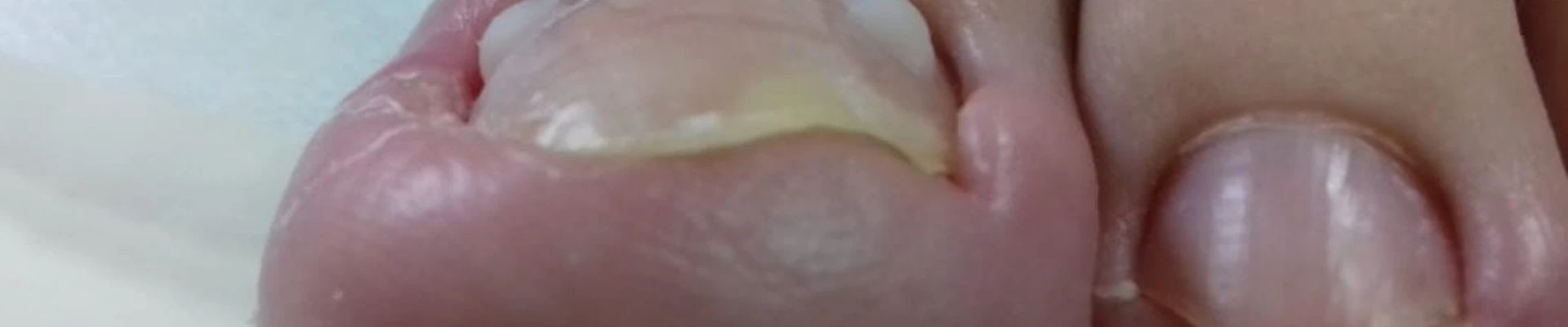 Подолог в Новочебоксарске