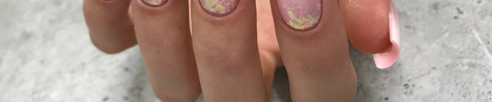 Gr-nail