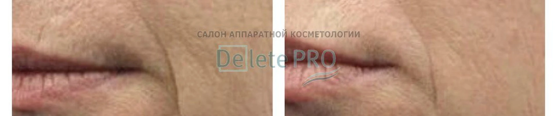 Delete.pro
