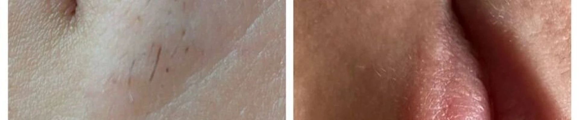 NeSpa в Белгороде Белгородская область, Белгород, Железнодорожная улица, 8а, 106 кабинет; 1 этаж