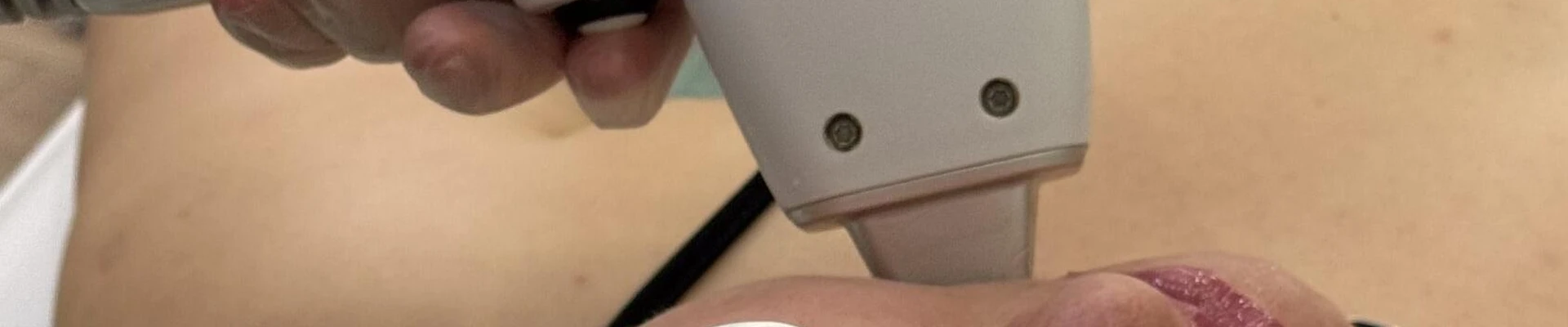 Laser Love в Ижевске Россия, Удмуртская Республика, Ижевск, улица имени Вадима Сивкова, 273, офис 2, ЖК "ECO Life 2"