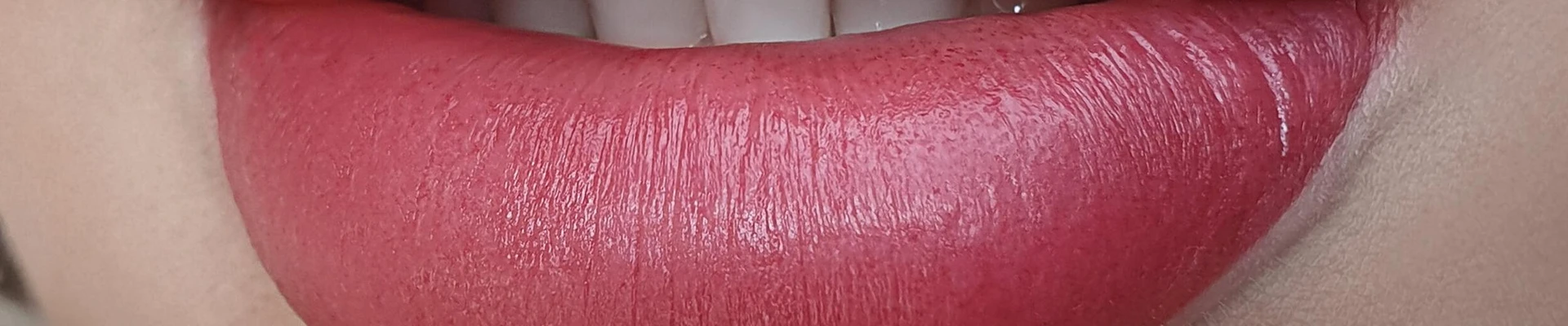 &