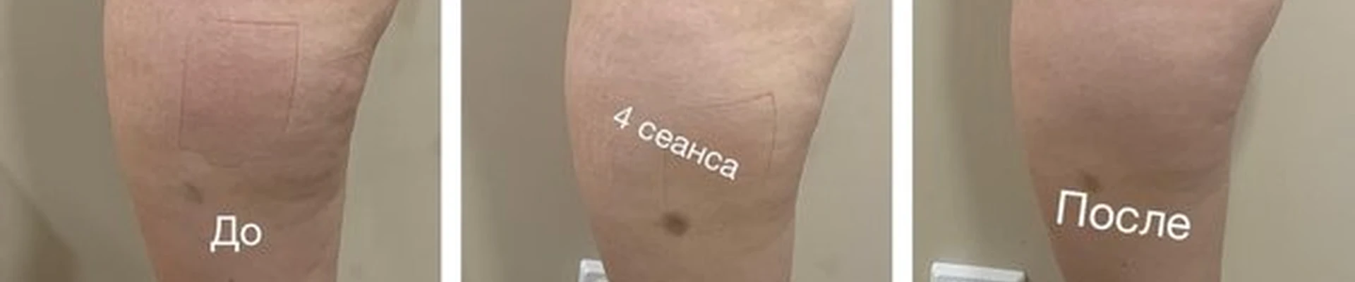 Beauty Body в Санкт-петербурге проспект Космонавтов, 42