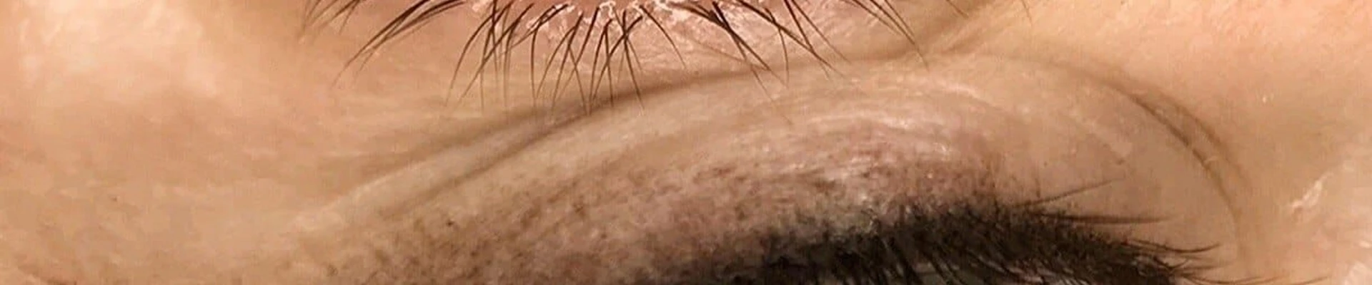 Лазермед Эстетика