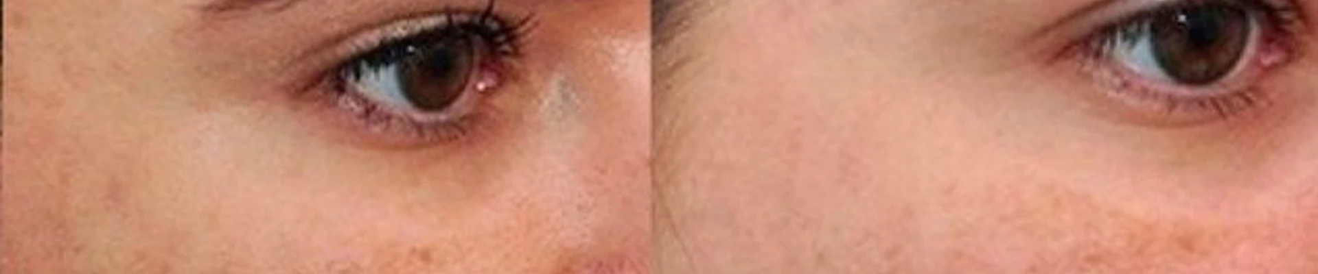 White laser в Каспийске улица Ленина, 35