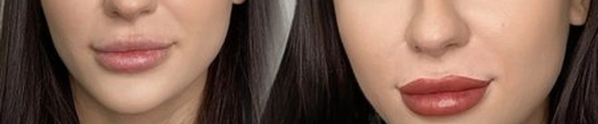 Anika. Aless