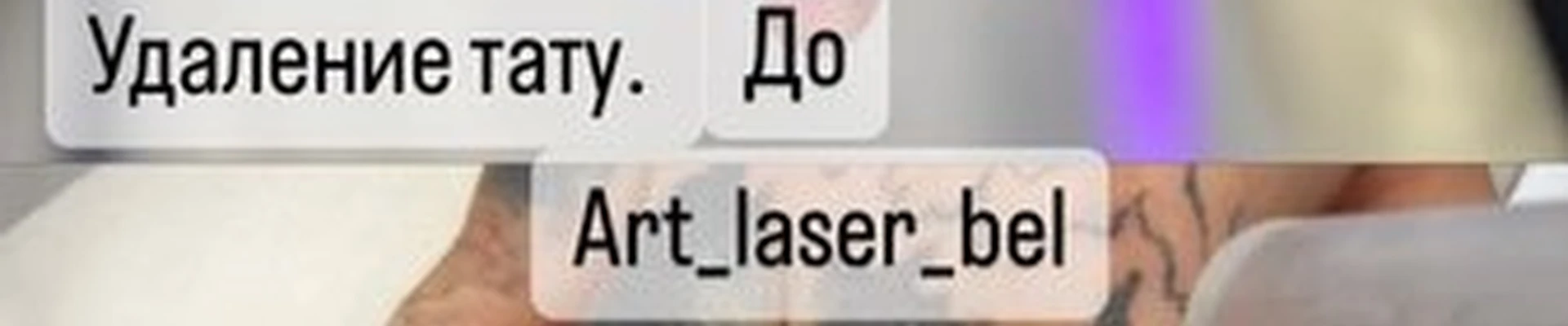 Apt Laser
