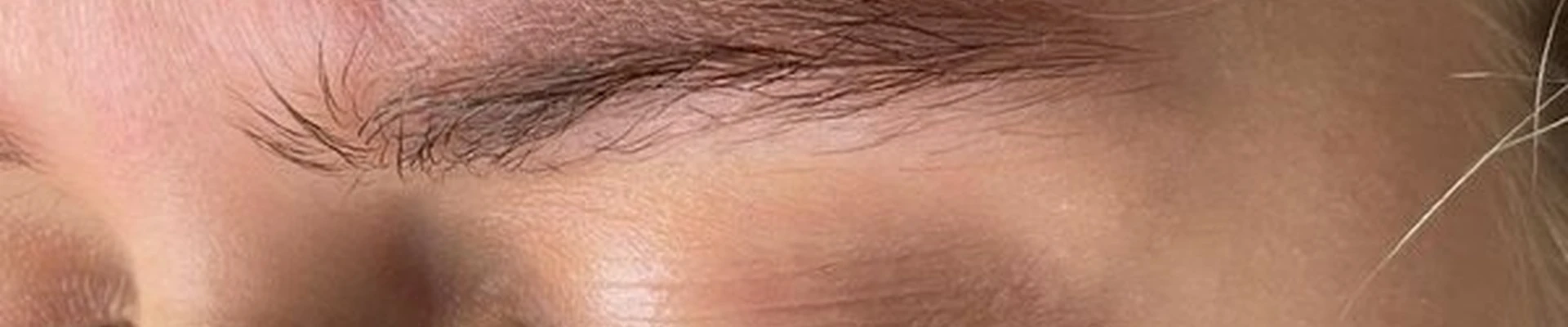 arm_laser