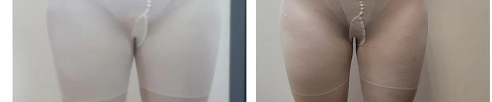 Magic body