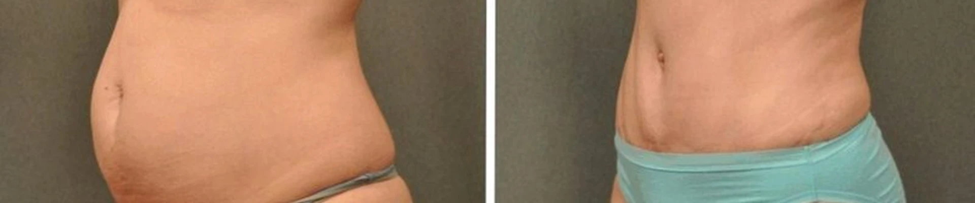 Азалия в Новосибирске улица Фрунзе, 5 ст2