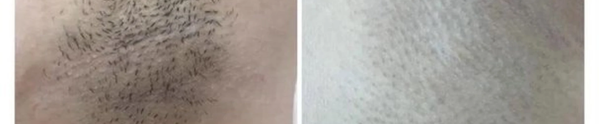 Beauty Laser в Астрахани улица Красная Набережная, 28