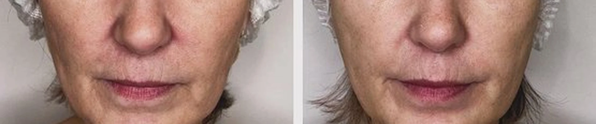 Beauty bar в Осинниках улица Победы, 46