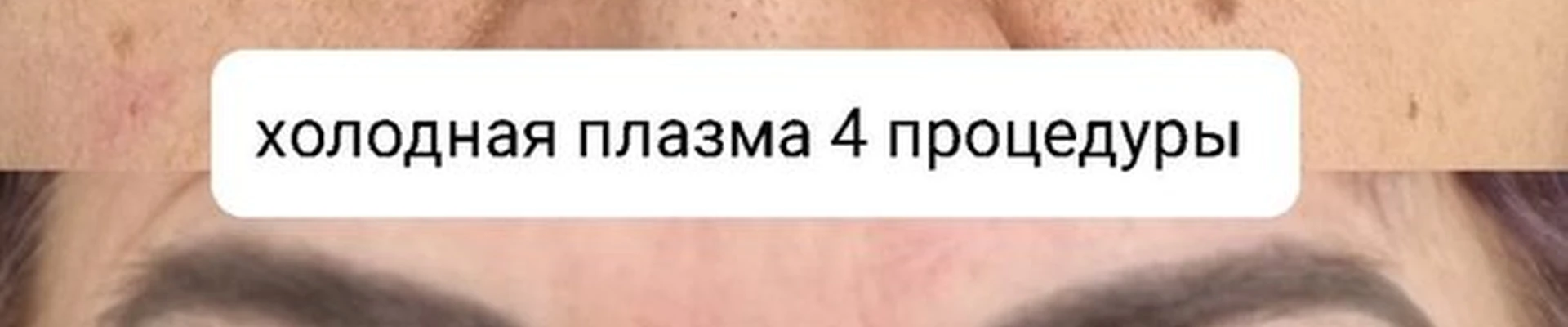 Face_massage65