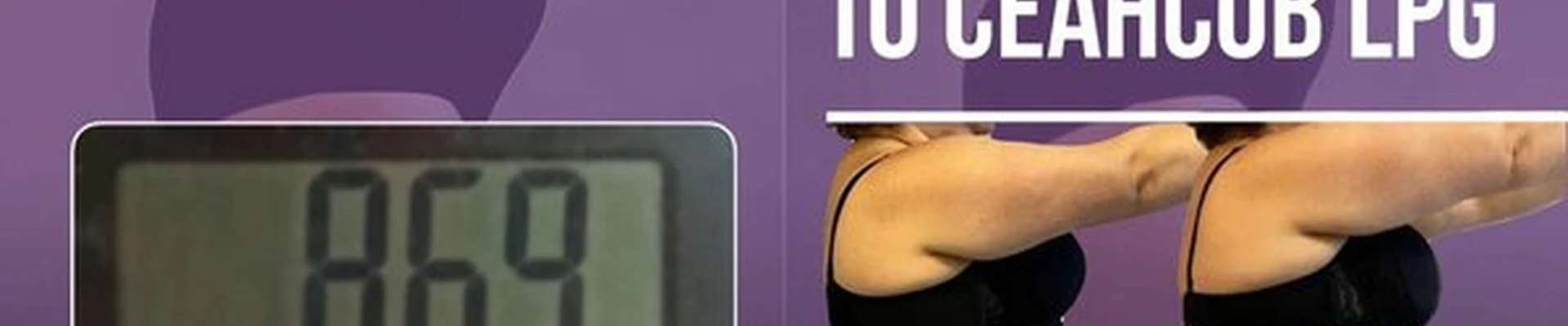 Fleur в Калининграде Виллима Фермора, 3