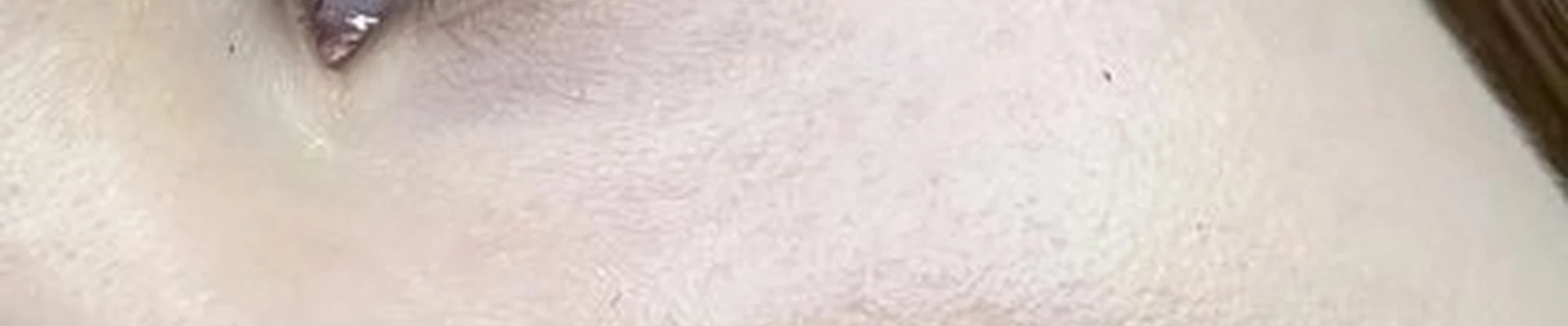 Anlex