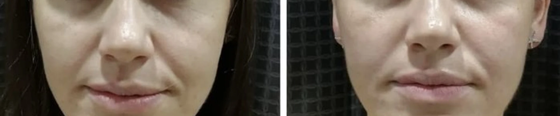 Auro faciem