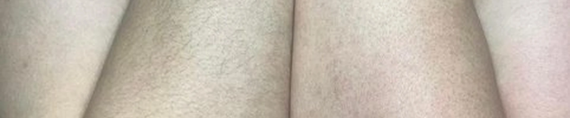 Sweet Wink