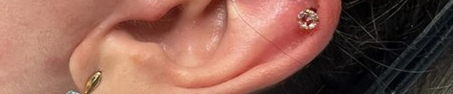 &