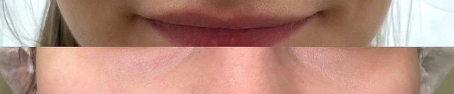 Epilux clinic