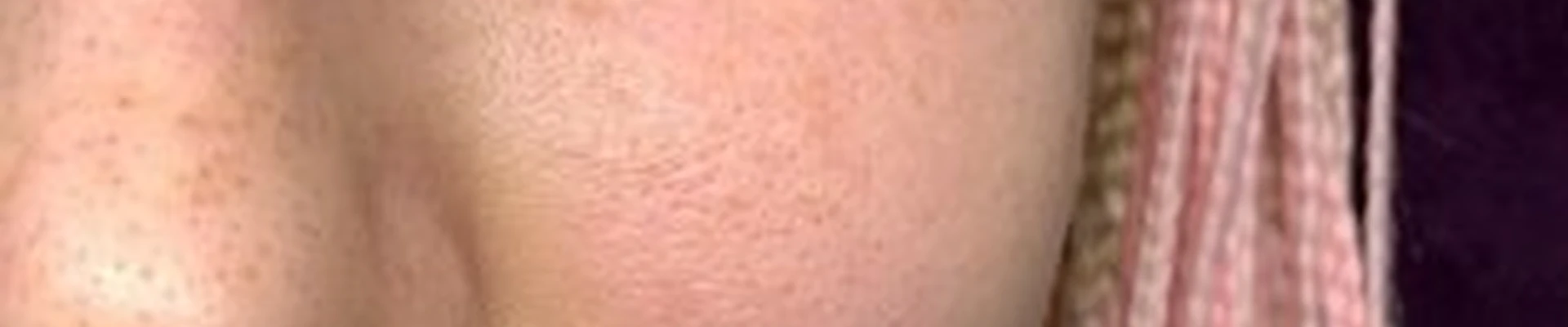 Bezlimit_cosmetolog