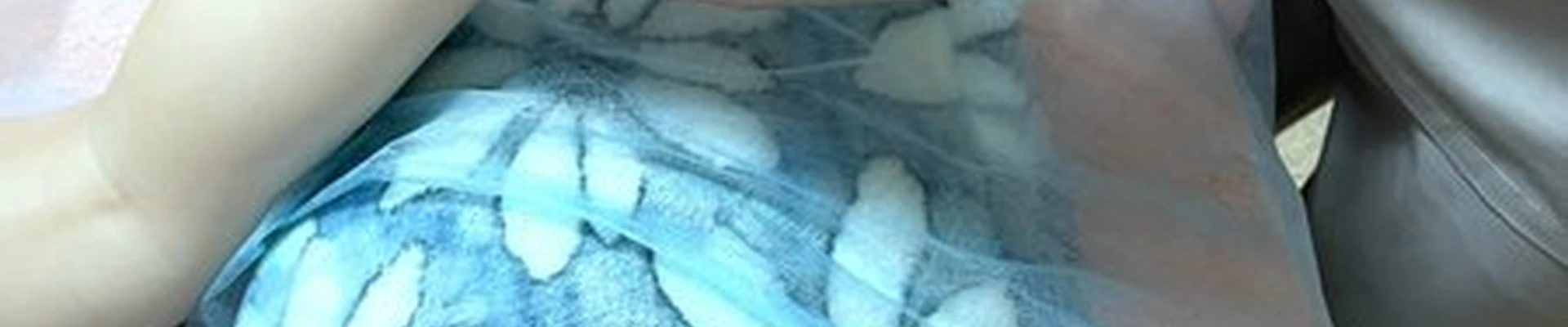 Кинезио в Северске улица Калинина, 35