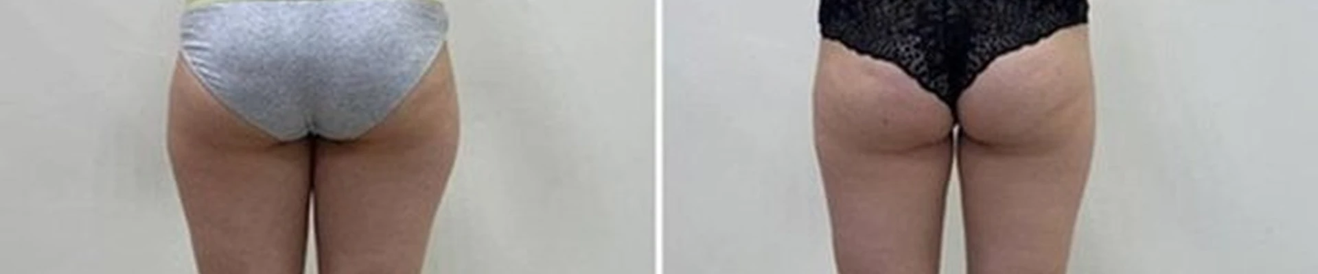 Male в Йошкар-оле Зелёная улица, 1Б