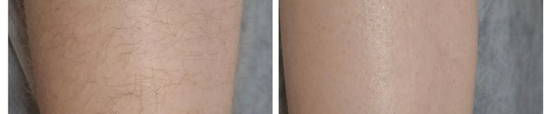 Lotos в Якутске Маганский тракт 2 километр, 7/6