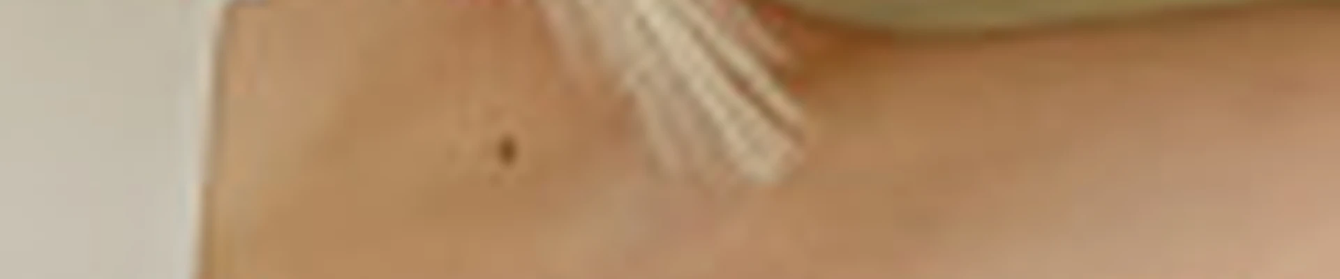 Epilbody