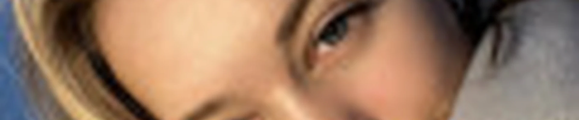 lash_skintey