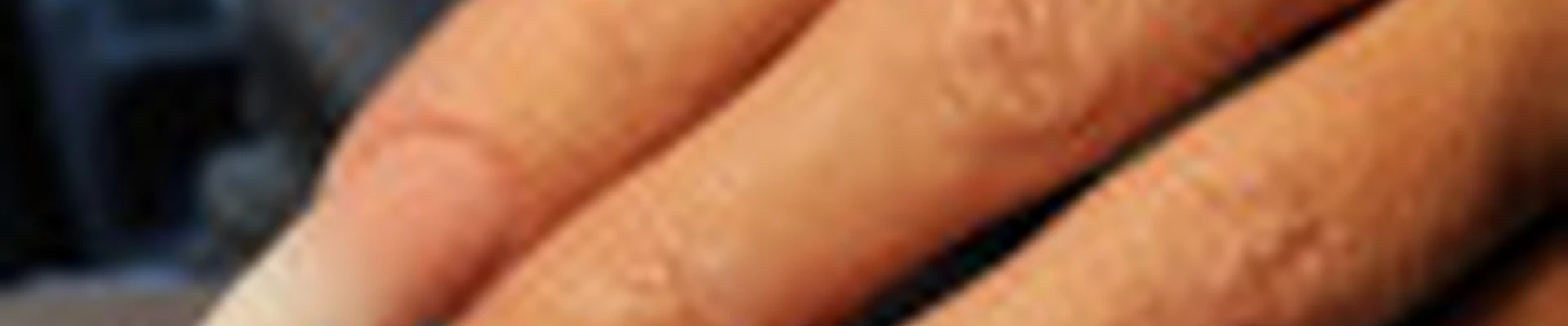 И Руки и Ноги