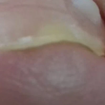 Подолог в Новочебоксарске