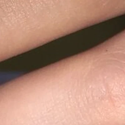 &