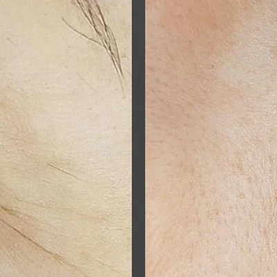 Anni_Tattooage