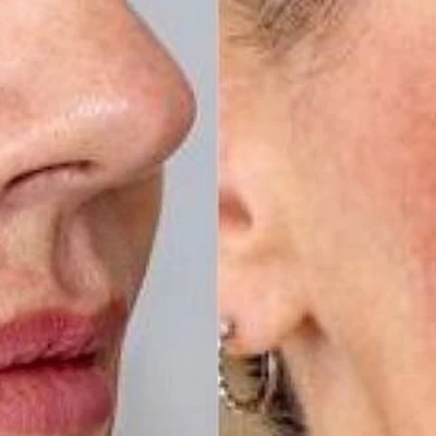 Медицинский центр косметологии и пирсинга