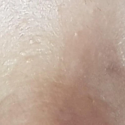 &