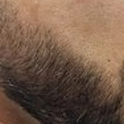 Ferraz