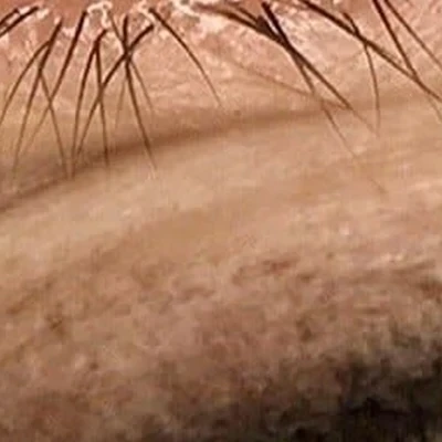 Лазермед Эстетика