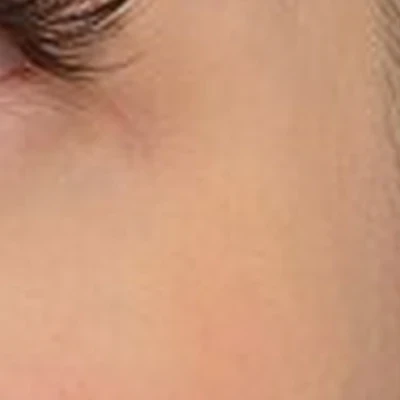 2nasti