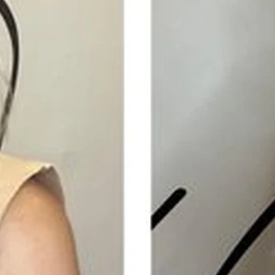Hairkot