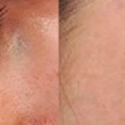 White laser в Каспийске улица Ленина, 35