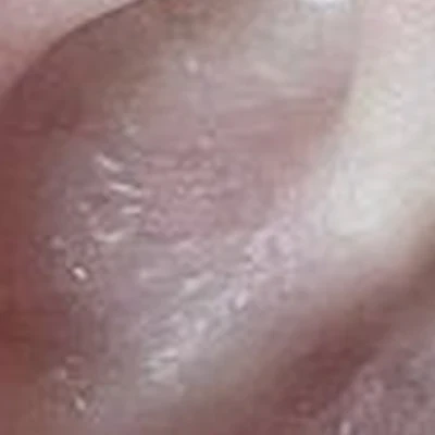 Beauty Kiss