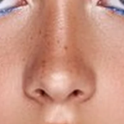 Beautystar