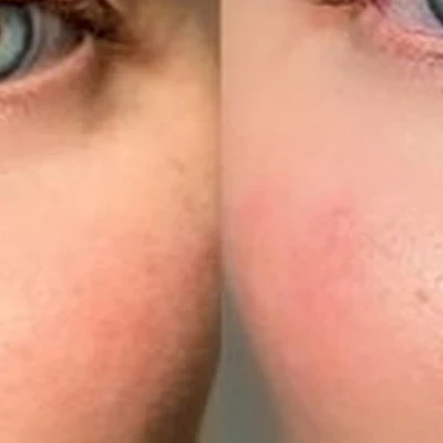 Cosmey