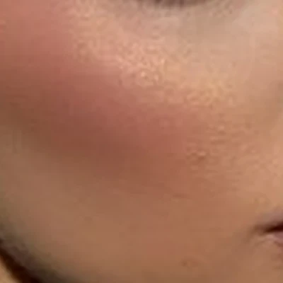 Shimmers