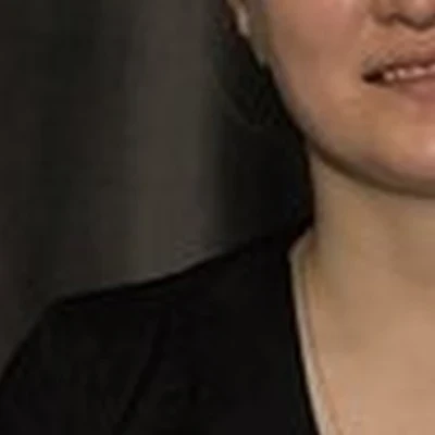 Elstetic_face