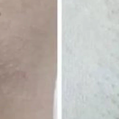 Beauty Laser в Астрахани улица Красная Набережная, 28