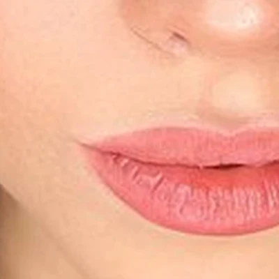 Aesthetic cosmetology в Калининграде улица Подполковника Емельянова, 223