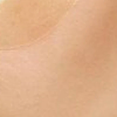 Aviva laser в Екатеринбурге улица Краснолесья, 133