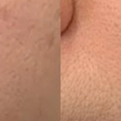 &