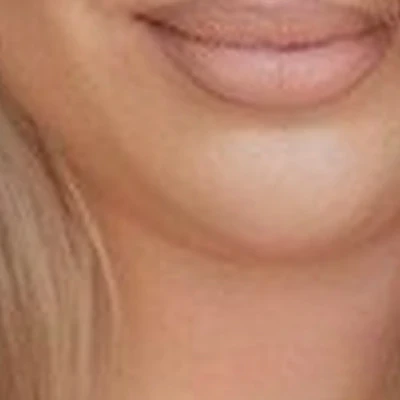 Body LPG в Копейске Дарвина, 13